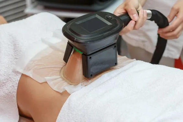 Image of person having fat freezing treatment to help weight gain Harwich