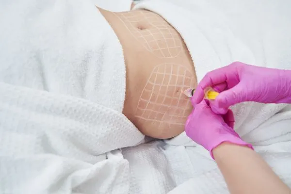 image of fat dissolving injections on love handles to help combat weight gain Harwich