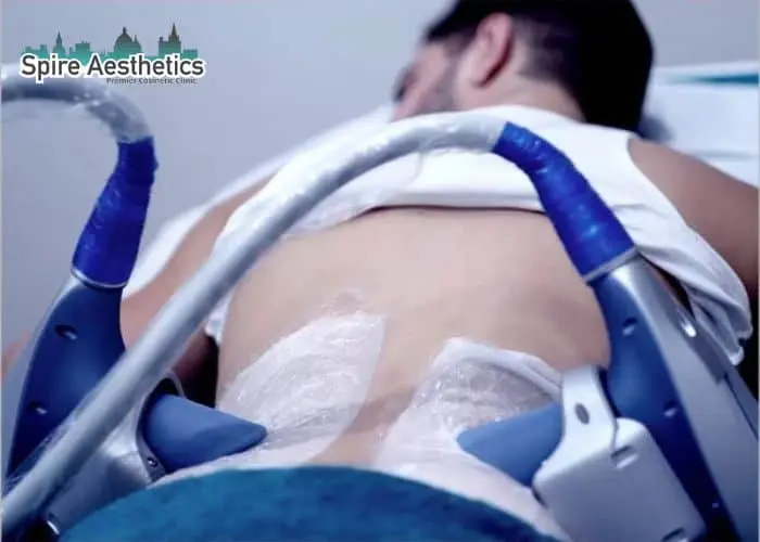 Man having fat freezing treatment done on love handles before a competitions Harwich to create a sculpted look.