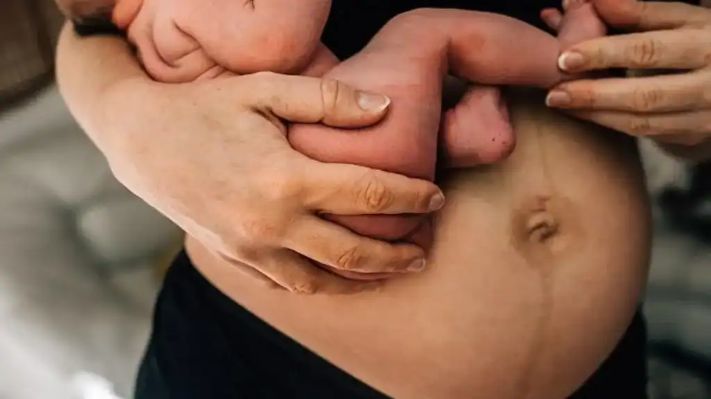 Why Is My Stomach Still Big After Pregnancy Harwich?